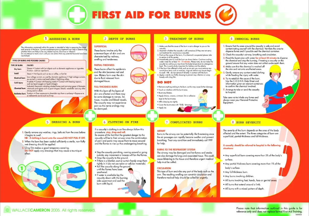 [5405034] Poster First Aid for Burns 84cm x 59cm